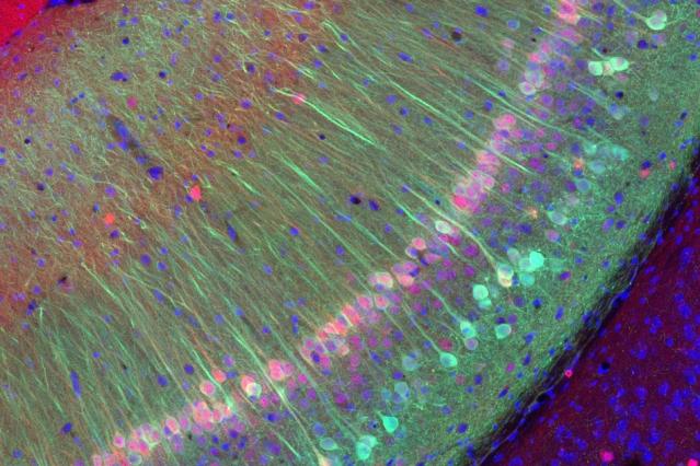 美科学家发现控制清醒程度的神经元