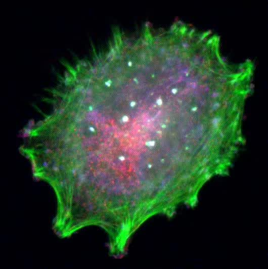 研究人员发现癌细胞会派“无人机”打击免疫系统