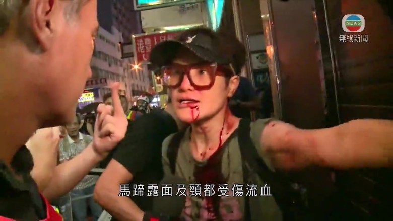 香港艺人马蹄露遇袭后首度受访：我不是英雄，当时只是想吓退黑衣人