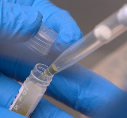 In this Nov. 20, 2019 image from video, National Institute of Health researchers test patient samples in Bethesda, Md. The NIH has more than doubled funding -- to more than $14 million -- for scientists around the country to unravel the biology of ME/CFS, also known as chronic fatigue syndrome, since 2015, when the influential Institute of Medicine decried “a paucity of research.” (AP Photo/Federica Narancio)