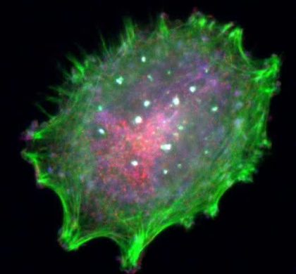研究人员发现癌细胞会派“无人机”打击免疫系统