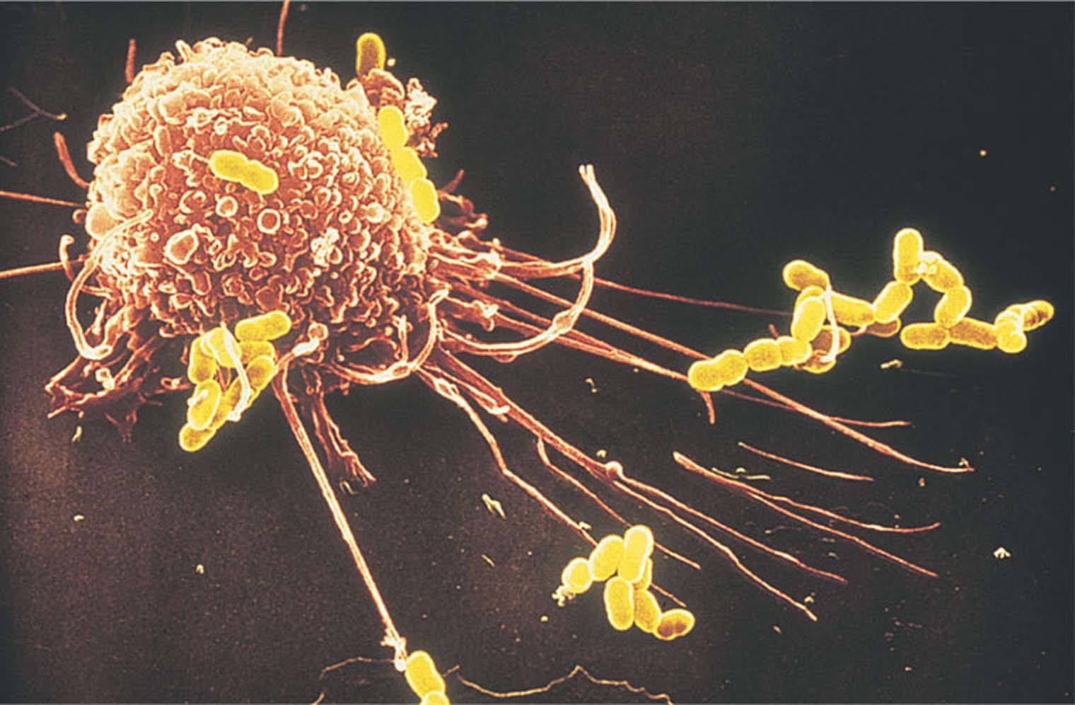 美科学家确认癌细胞可“远程缴械”免疫系统