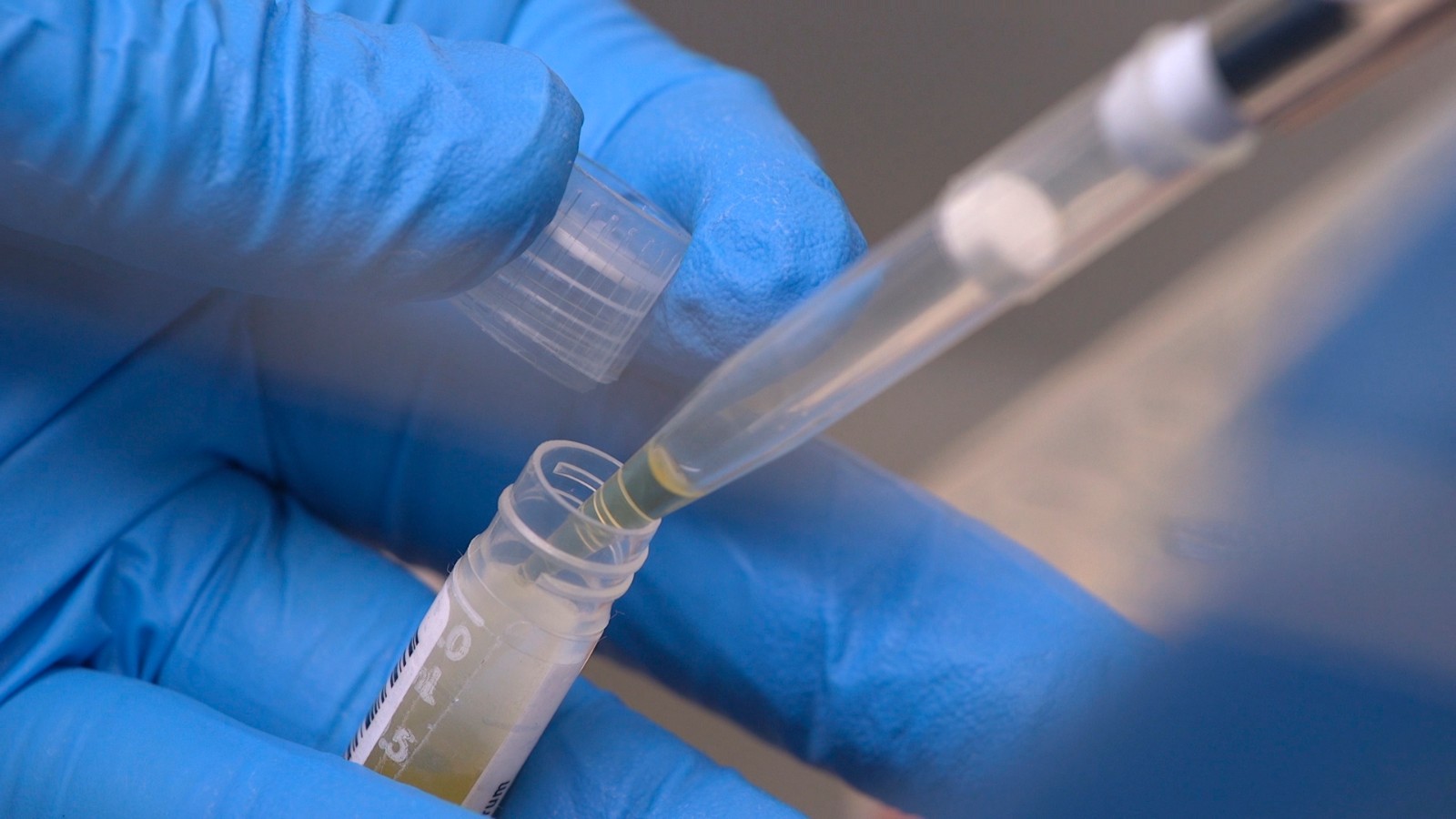 In this Nov. 20, 2019 image from video, National Institute of Health researchers test patient samples in Bethesda, Md. The NIH has more than doubled funding -- to more than $14 million -- for scientists around the country to unravel the biology of ME/CFS, also known as chronic fatigue syndrome, since 2015, when the influential Institute of Medicine decried “a paucity of research.” (AP Photo/Federica Narancio)